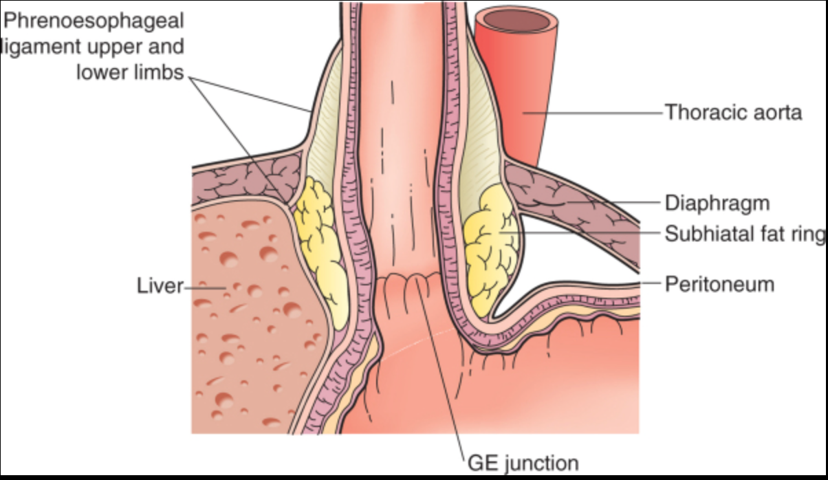A Professional's Guide to Testing for Hiatal Hernia and Acid Reflux
